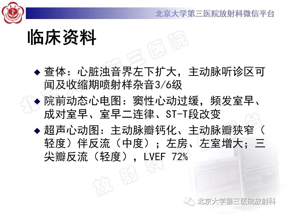 影像PPT - 【PPT】经导管主动脉瓣植入/置换术前CT评价-3