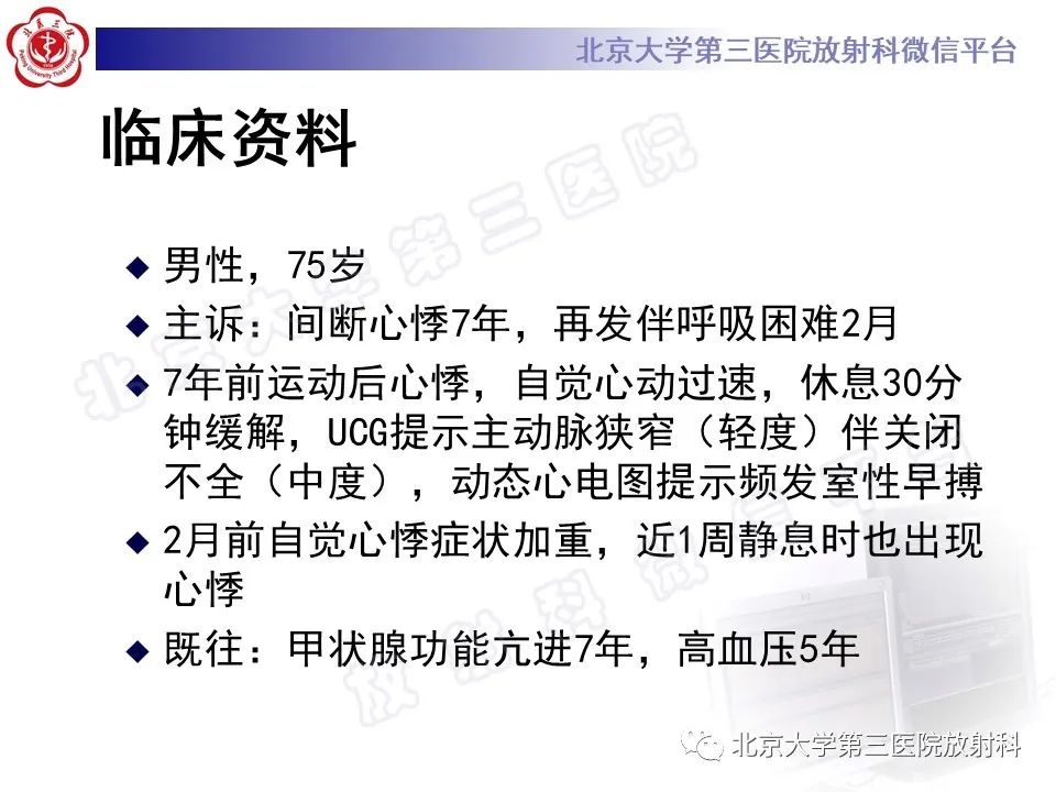 影像PPT - 【PPT】经导管主动脉瓣植入/置换术前CT评价-2
