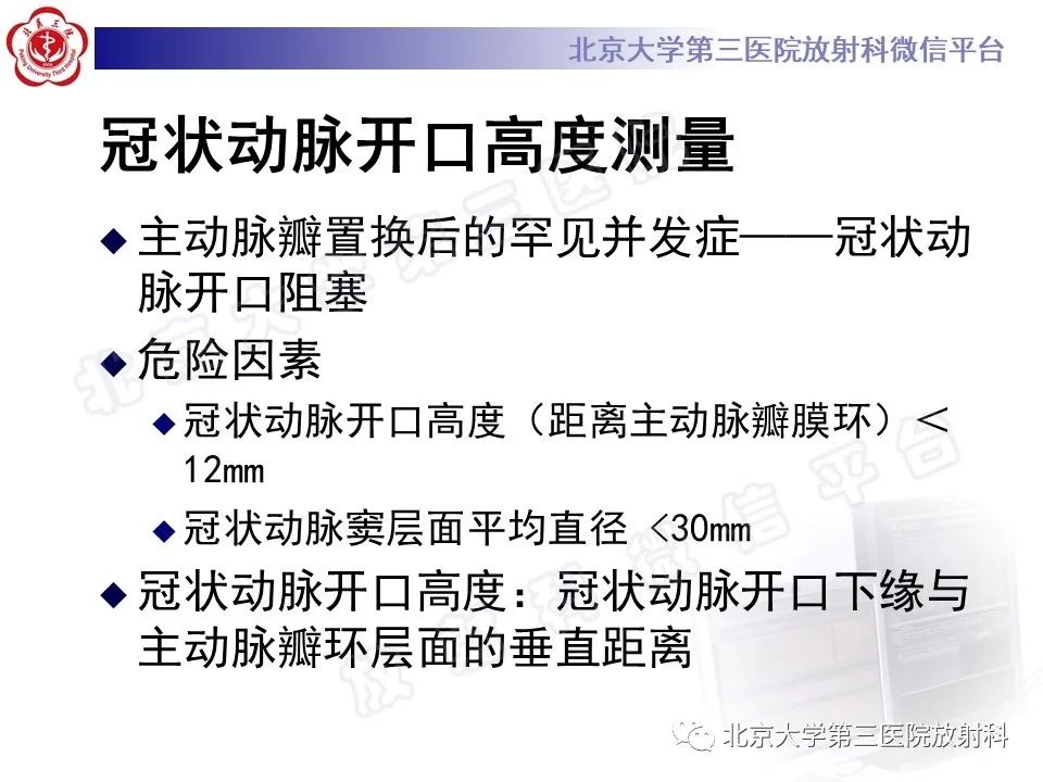 影像PPT - 【PPT】经导管主动脉瓣植入/置换术前CT评价-19