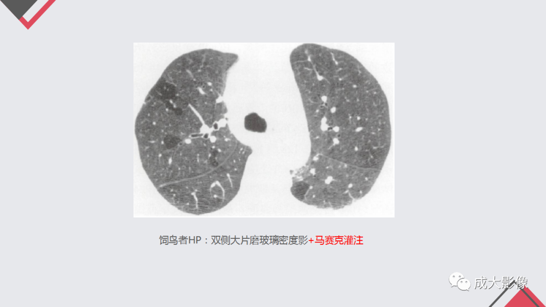 影像PPT - 【PPT】过敏性肺炎-13