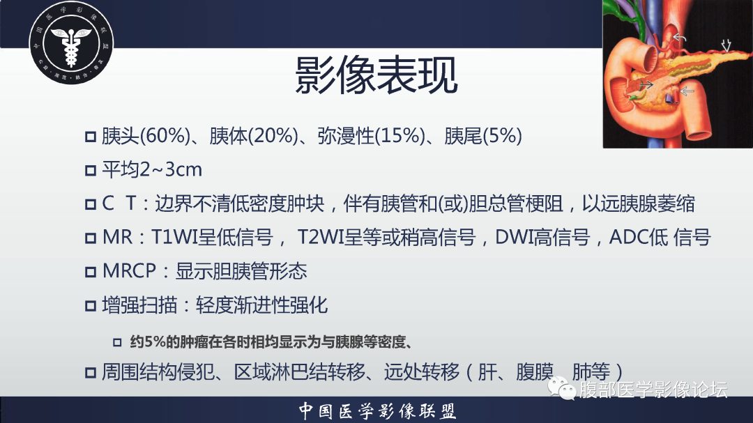 影像PPT - 【病例】胰腺高分化导管腺癌1例CT及MR影像-12