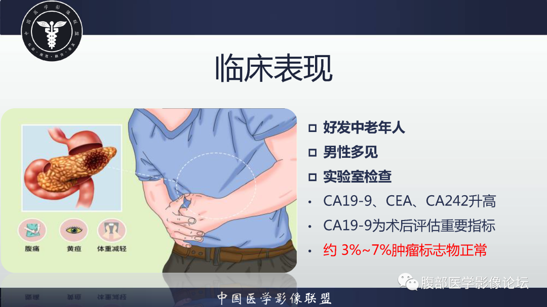 影像PPT - 【病例】胰腺高分化导管腺癌1例CT及MR影像-11