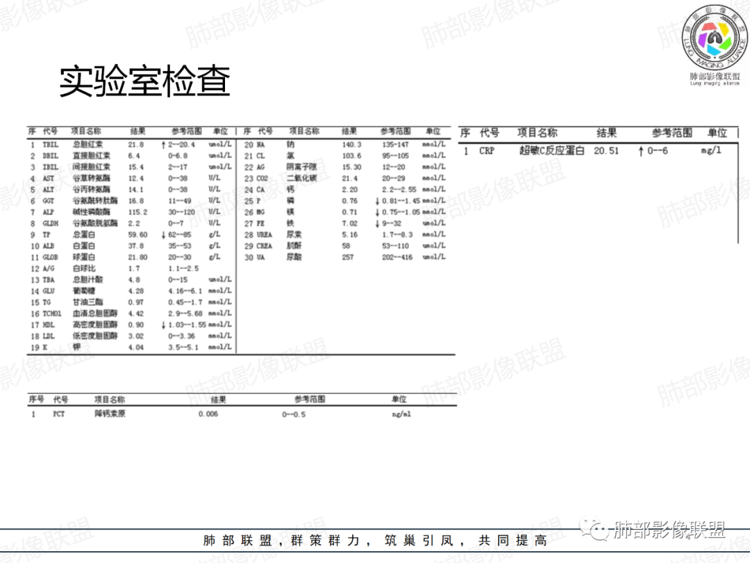 影像PPT - 【病例】中年男性,痰血,楔形跨段病变分析思路-4 影像PPT - 【病例】中年男性,痰血,楔形跨段病变分析思路-4
