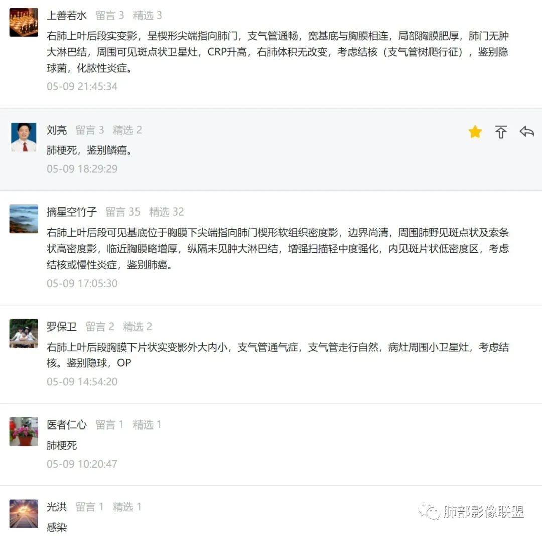 影像PPT - 【病例】中年男性,痰血,楔形跨段病变分析思路-14 影像PPT - 【病例】中年男性,痰血,楔形跨段病变分析思路-14