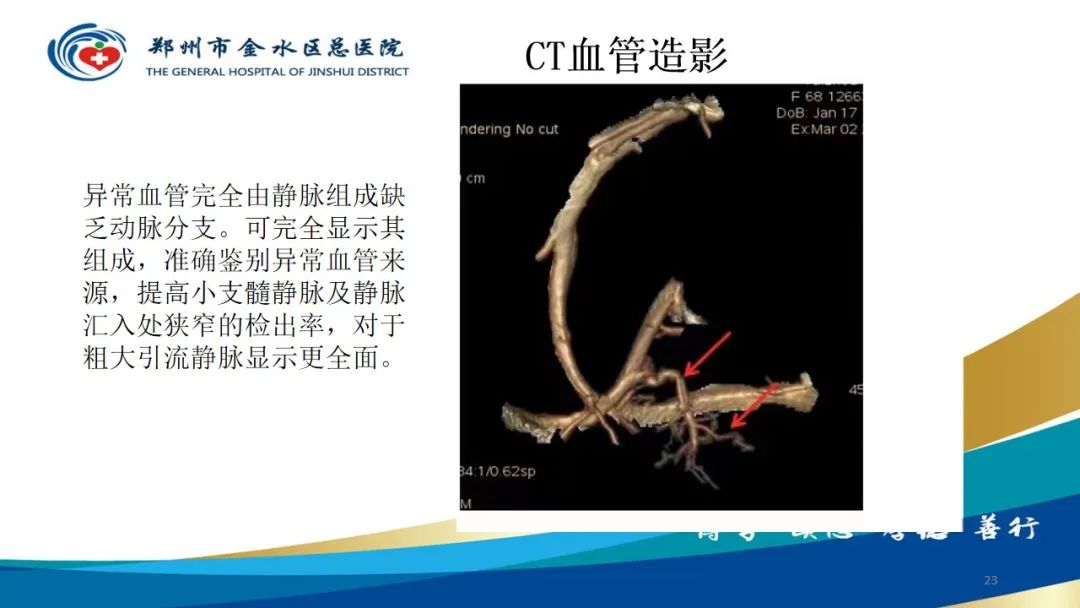 影像PPT - 【病例】脑内静脉畸形1例CT及MR影像-23
