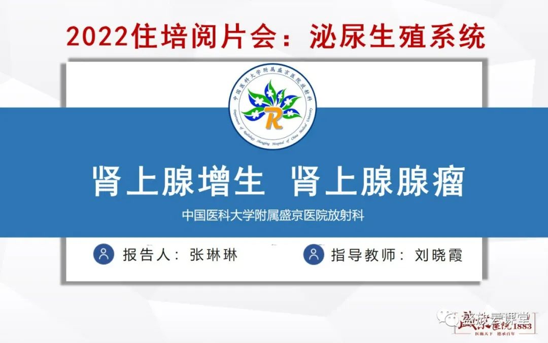 影像PPT - 【PPT】肾上腺增生 肾上腺腺瘤-1 影像PPT - 【PPT】肾上腺增生 肾上腺腺瘤-1