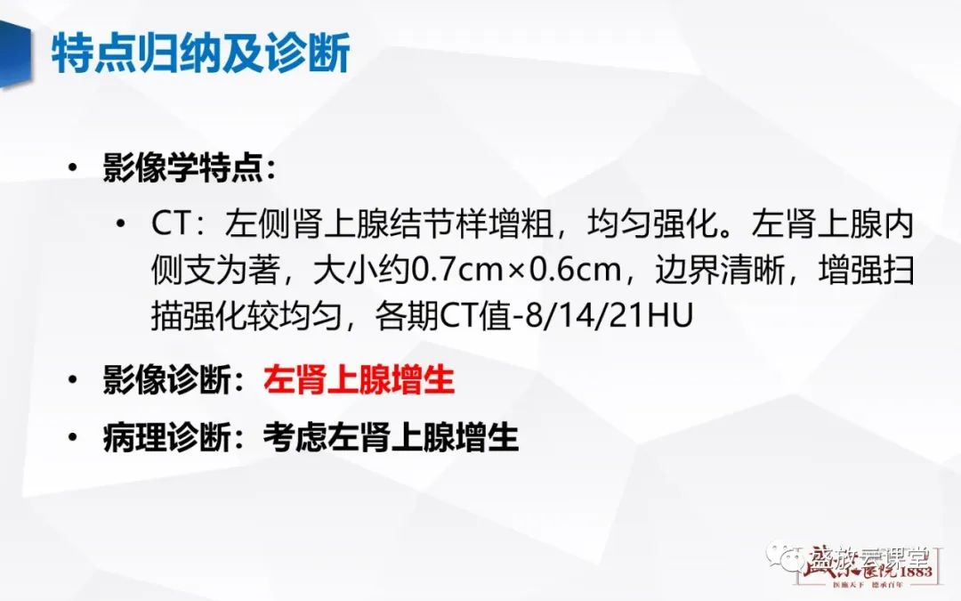 影像PPT - 【PPT】肾上腺增生 肾上腺腺瘤-6 影像PPT - 【PPT】肾上腺增生 肾上腺腺瘤-6