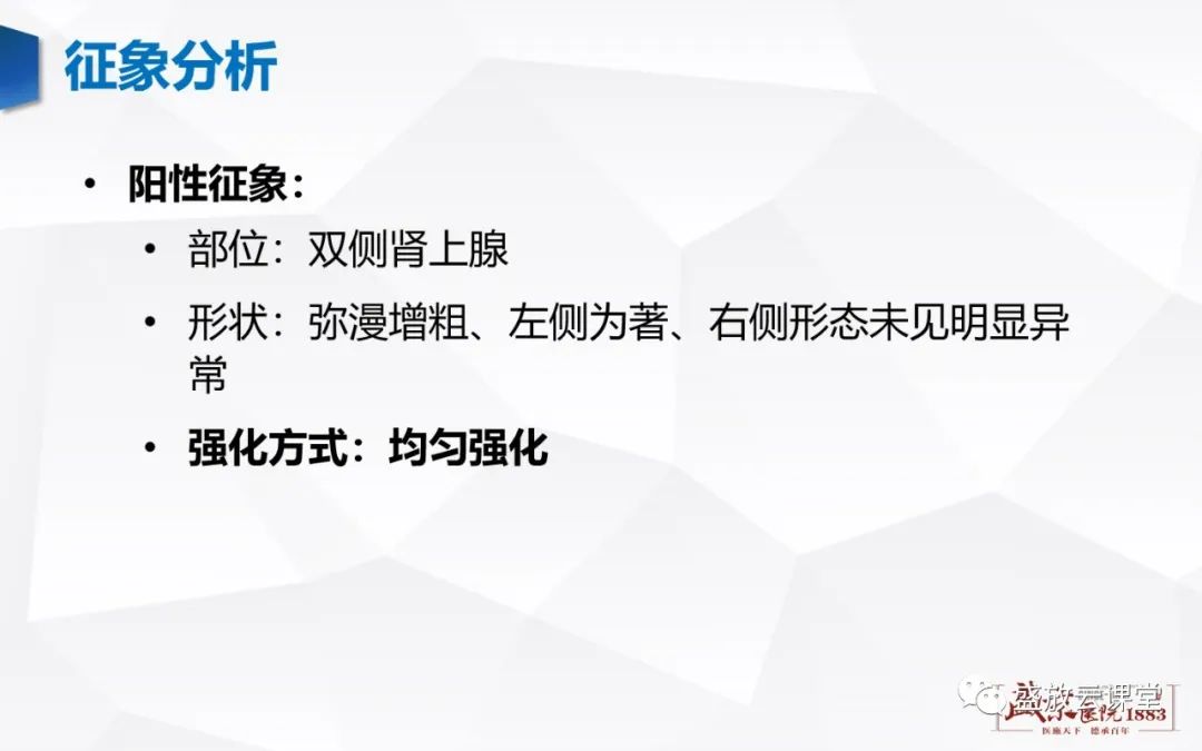 影像PPT - 【PPT】肾上腺增生 肾上腺腺瘤-10 影像PPT - 【PPT】肾上腺增生 肾上腺腺瘤-10