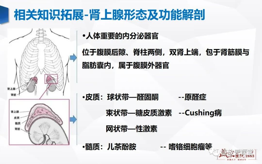 影像PPT - 【PPT】肾上腺增生 肾上腺腺瘤-17 影像PPT - 【PPT】肾上腺增生 肾上腺腺瘤-17