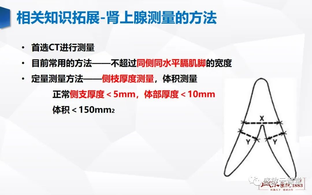 影像PPT - 【PPT】肾上腺增生 肾上腺腺瘤-18 影像PPT - 【PPT】肾上腺增生 肾上腺腺瘤-18