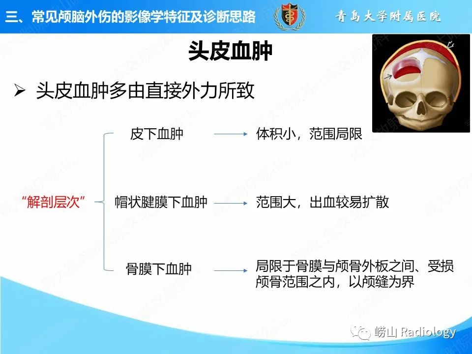 影像PPT - 【PPT】颅脑外伤性疾病-14