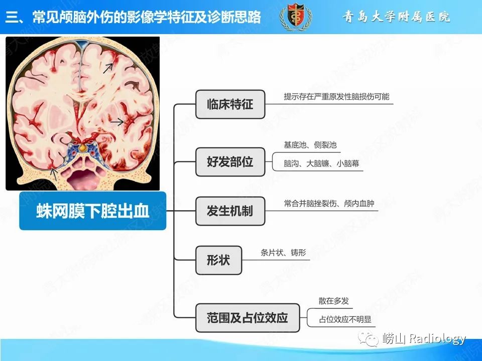 影像PPT - 【PPT】颅脑外伤性疾病-27