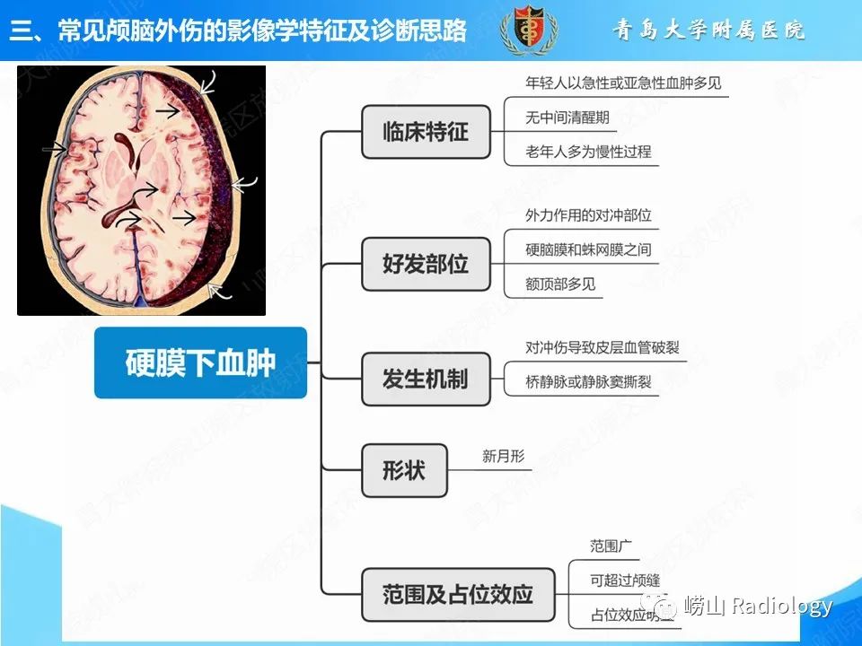 影像PPT - 【PPT】颅脑外伤性疾病-24