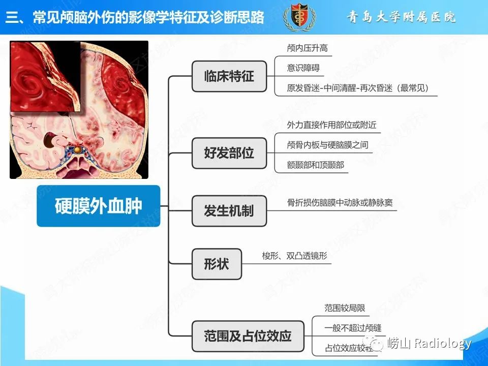 影像PPT - 【PPT】颅脑外伤性疾病-18