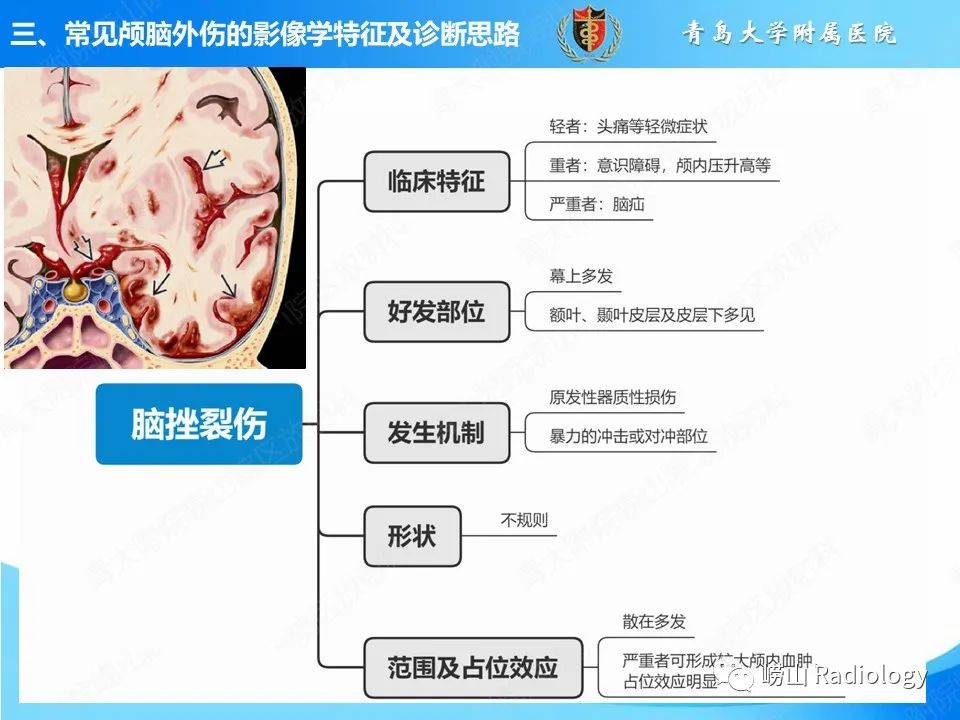 影像PPT - 【PPT】颅脑外伤性疾病-28