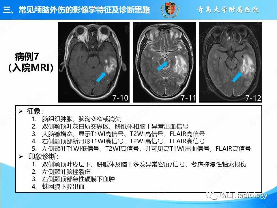 影像PPT - 【PPT】颅脑外伤性疾病-39
