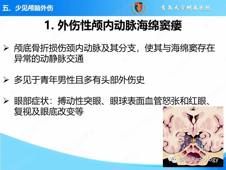 影像PPT - 【PPT】颅脑外伤性疾病-45