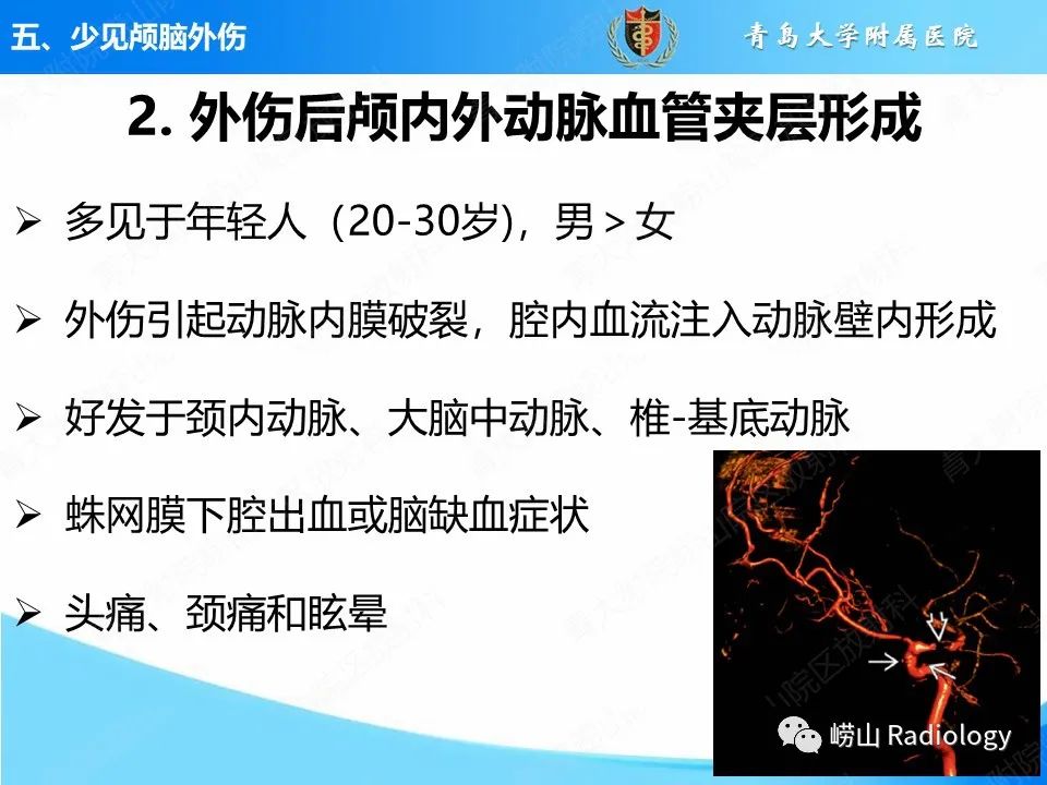影像PPT - 【PPT】颅脑外伤性疾病-48