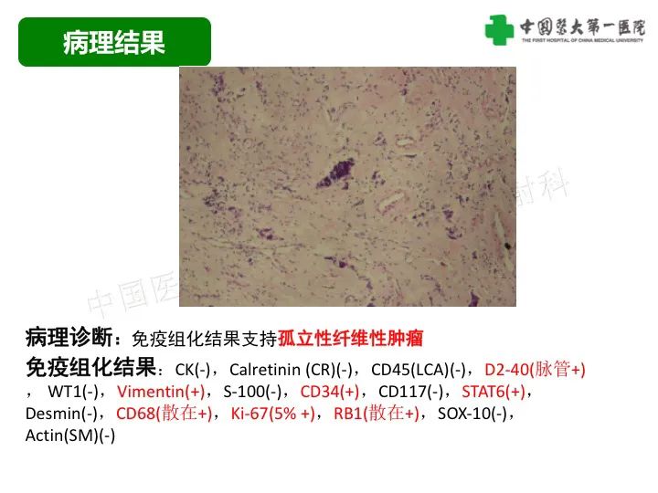 影像PPT - 【病例】胸膜孤立性纤维瘤1例CT影像-7
