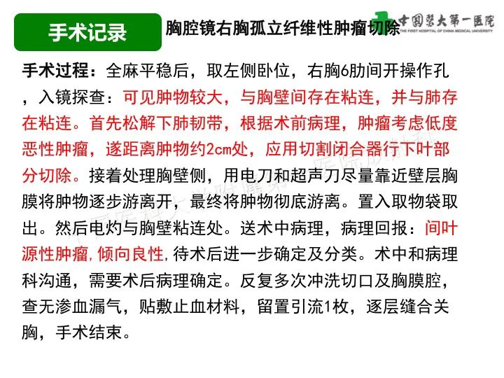 影像PPT - 【病例】胸膜孤立性纤维瘤1例CT影像-6