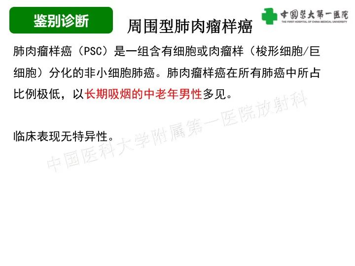 影像PPT - 【病例】胸膜孤立性纤维瘤1例CT影像-33