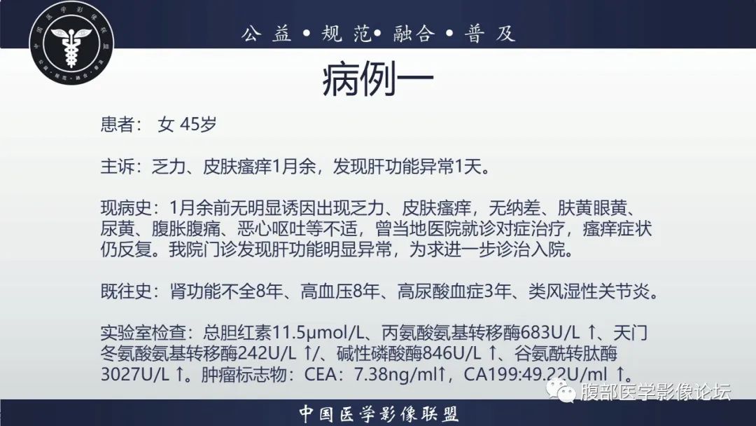 影像PPT - 【病例】胰腺神经内分泌肿瘤1例CT影像-2
