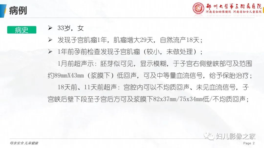 影像PPT - 【PPT】子宫肌瘤变性的影像诊断-2