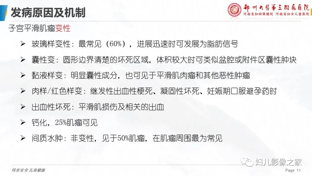 影像PPT - 【PPT】子宫肌瘤变性的影像诊断-11