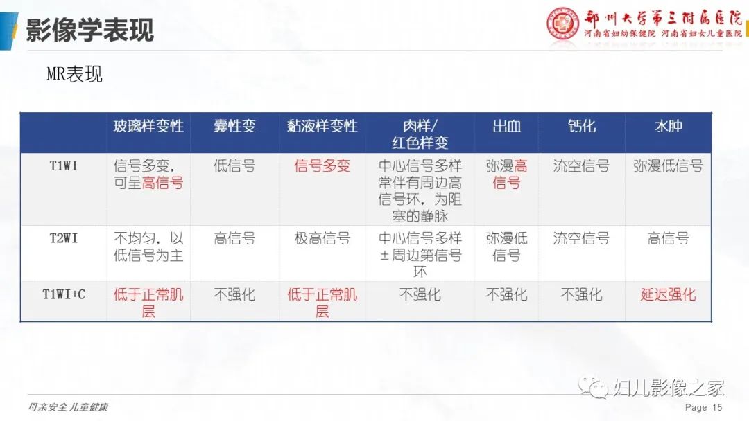 影像PPT - 【PPT】子宫肌瘤变性的影像诊断-15