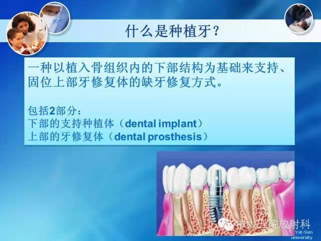影像PPT - 【PPT】种植牙CT照相与报告书写-3