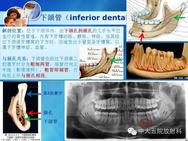 影像PPT - 【PPT】种植牙CT照相与报告书写-9