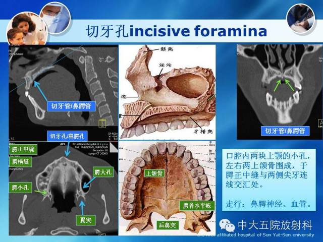 影像PPT - 【PPT】种植牙CT照相与报告书写-11