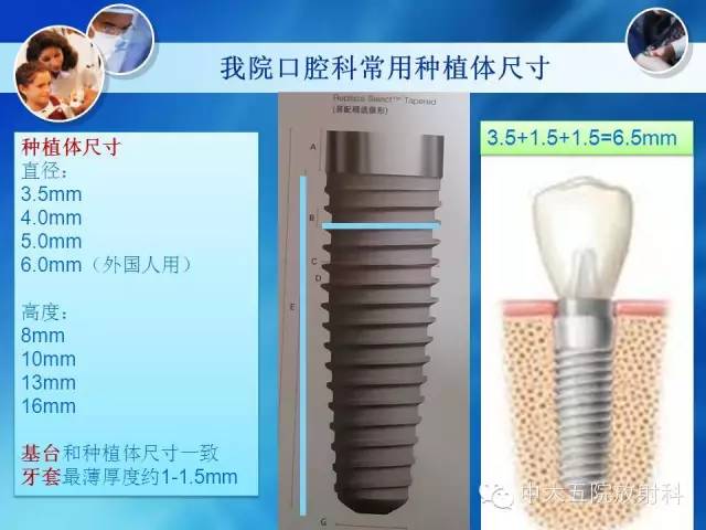 影像PPT - 【PPT】种植牙CT照相与报告书写-13