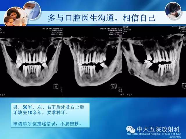 影像PPT - 【PPT】种植牙CT照相与报告书写-31