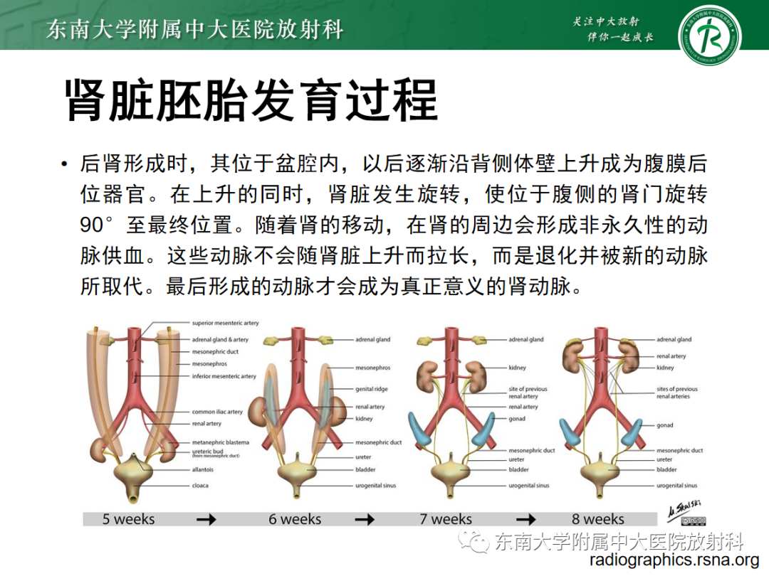 影像PPT - 【PPT】肾脏先天性发育异常-8