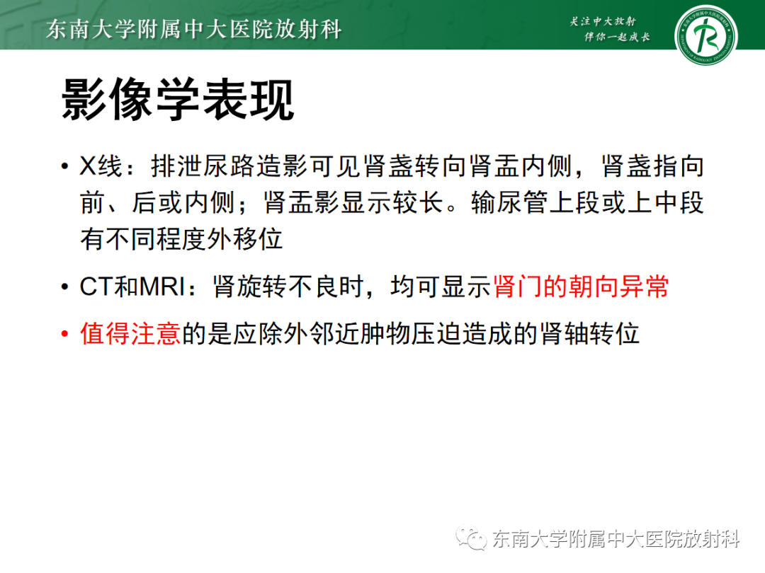 影像PPT - 【PPT】肾脏先天性发育异常-20