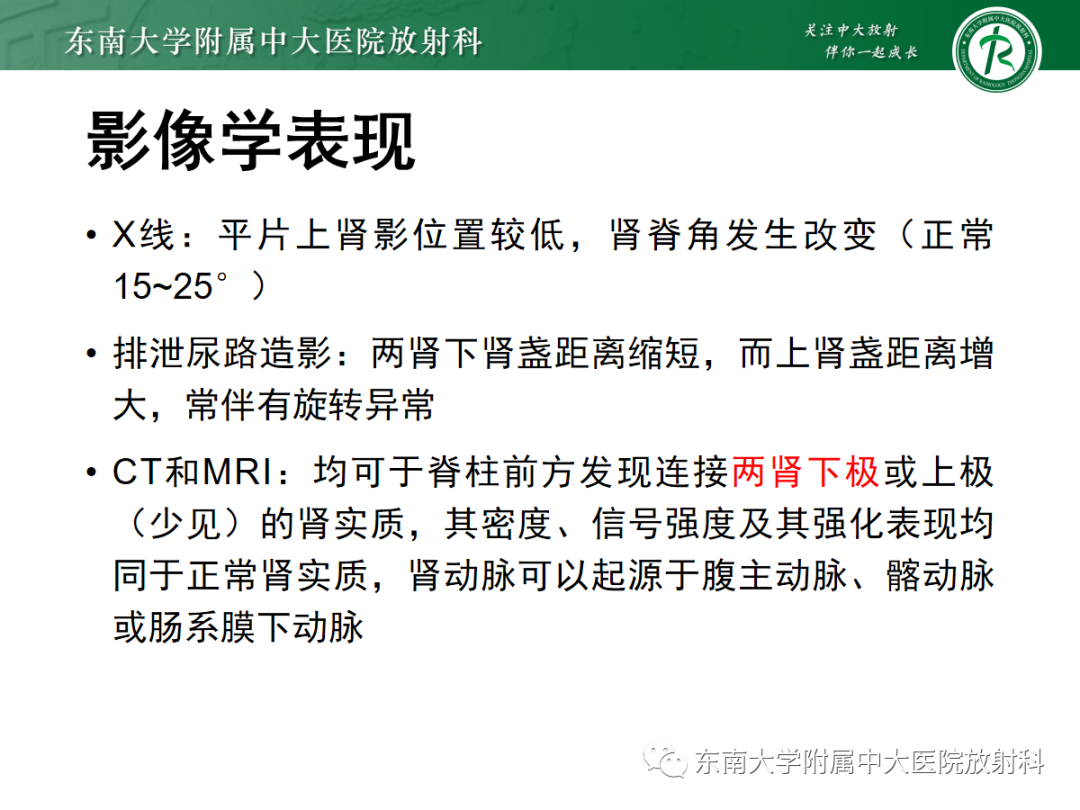 影像PPT - 【PPT】肾脏先天性发育异常-24