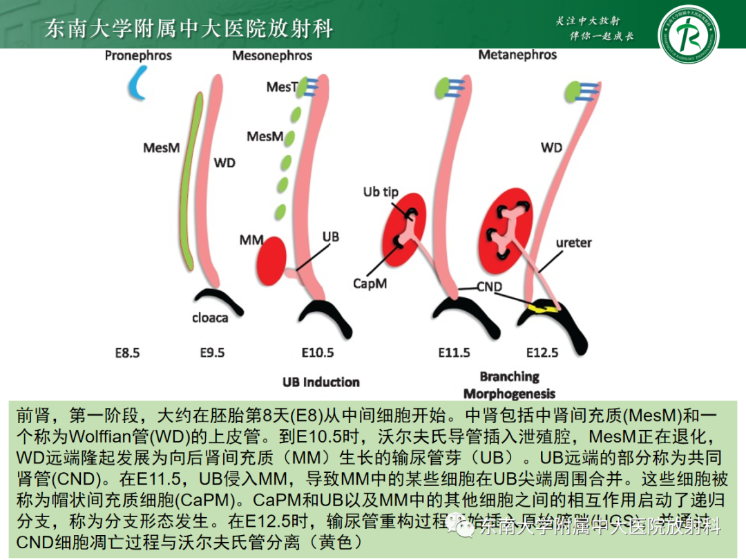 影像PPT - 【PPT】肾脏先天性发育异常-1