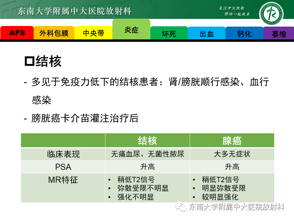 影像PPT - 【PPT】易误诊为前列腺癌的正常结构及良性病变-10