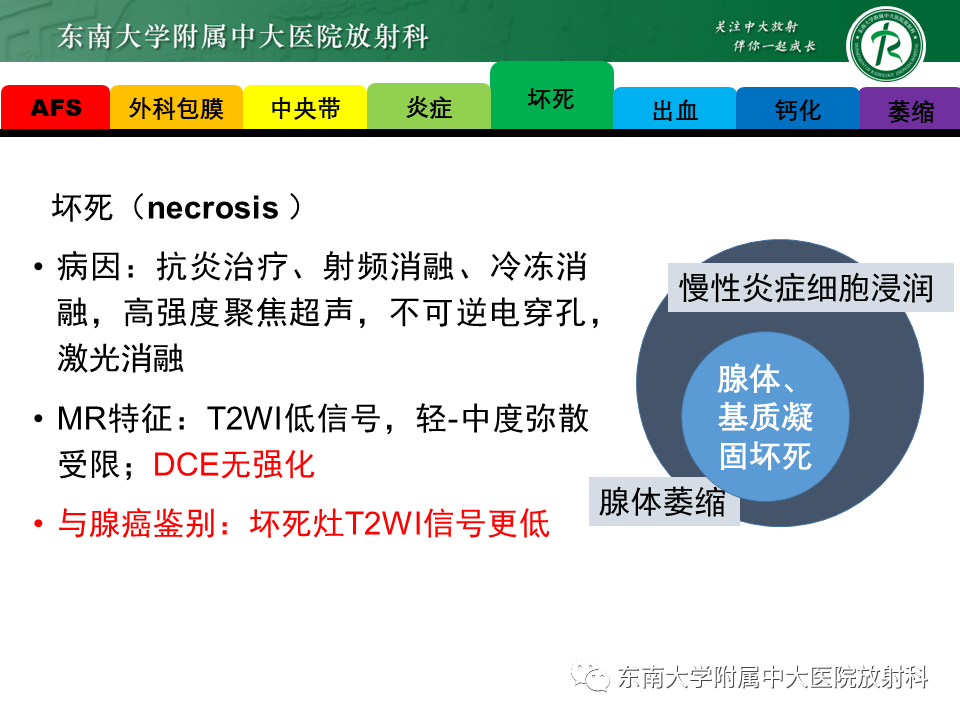 影像PPT - 【PPT】易误诊为前列腺癌的正常结构及良性病变-12