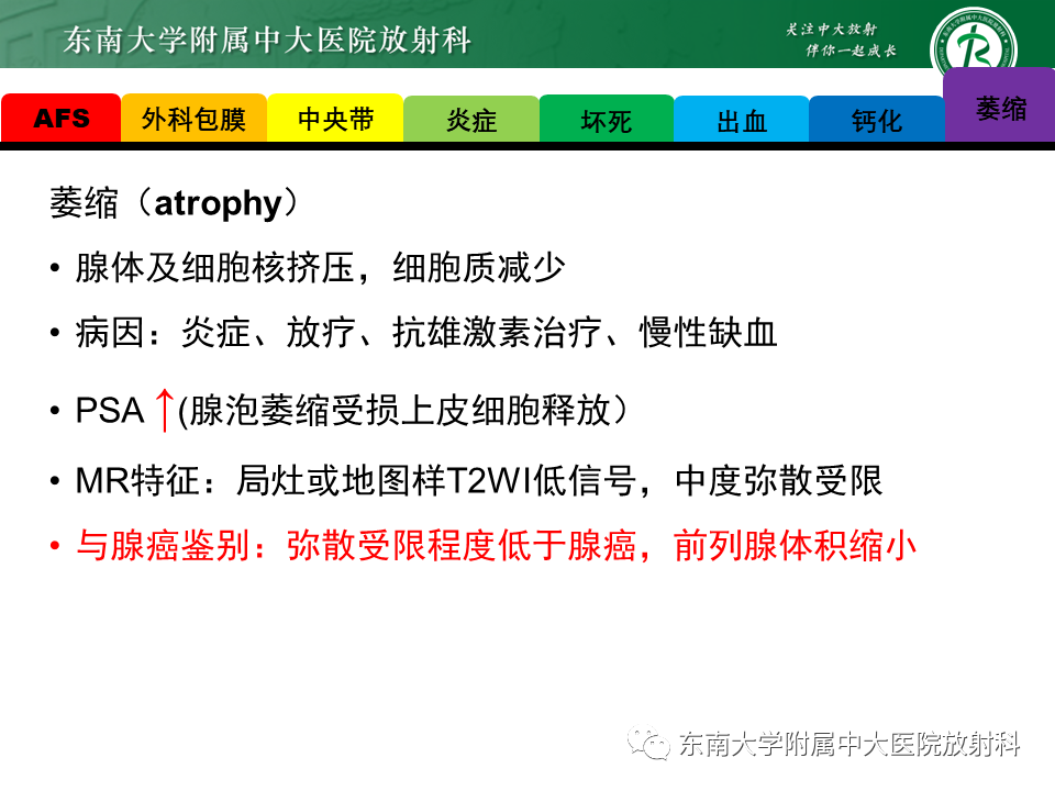 影像PPT - 【PPT】易误诊为前列腺癌的正常结构及良性病变-15