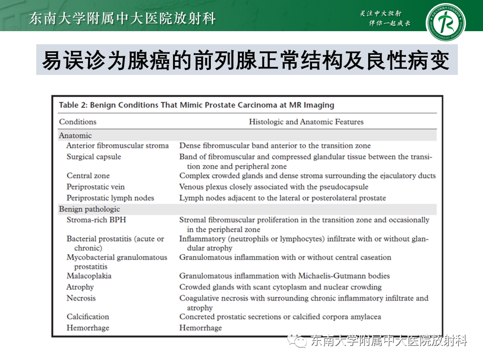 影像PPT - 【PPT】易误诊为前列腺癌的正常结构及良性病变-17