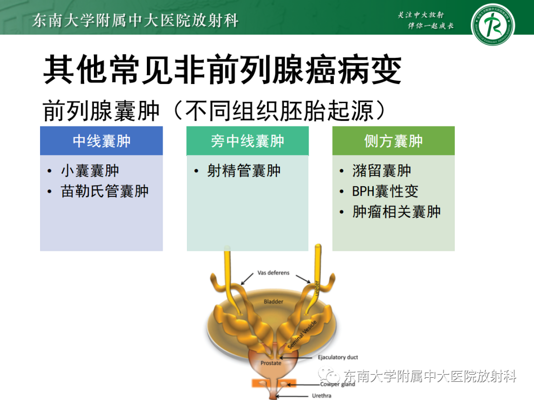 影像PPT - 【PPT】易误诊为前列腺癌的正常结构及良性病变-18