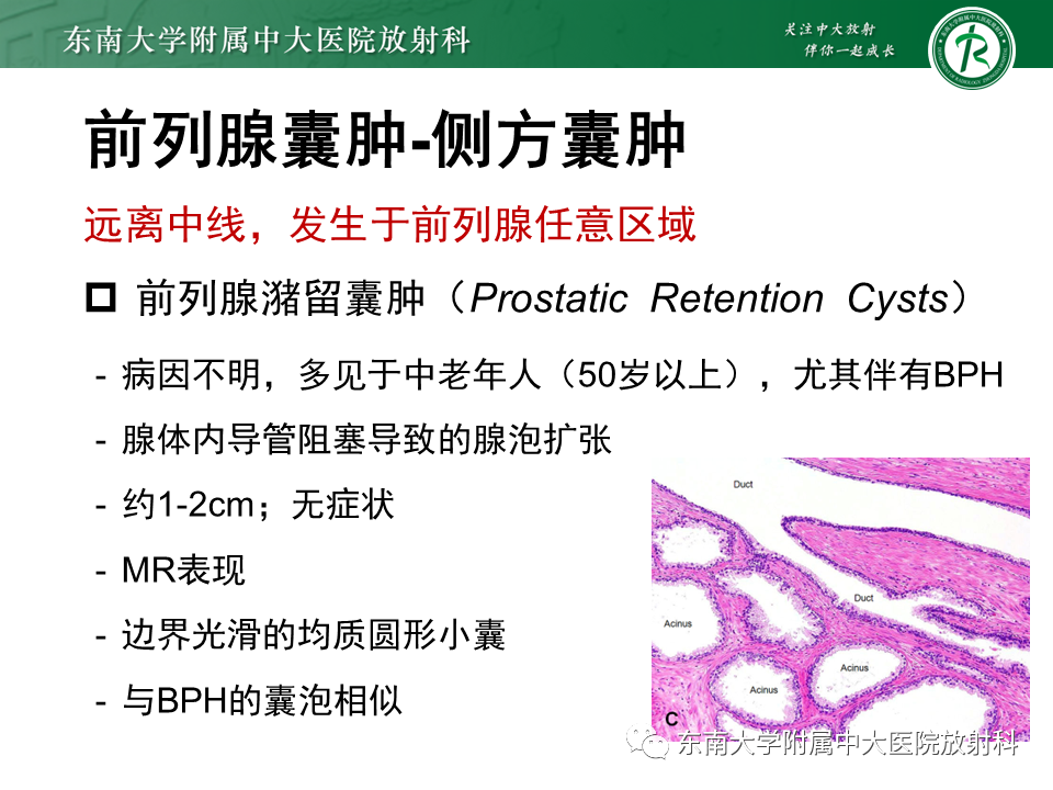影像PPT - 【PPT】易误诊为前列腺癌的正常结构及良性病变-32