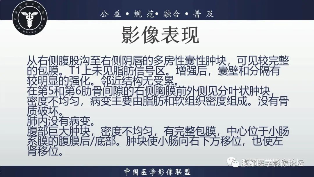 影像PPT - 【病例】外阴脂肪母细胞瘤样肿瘤1例CT及MR影像-14