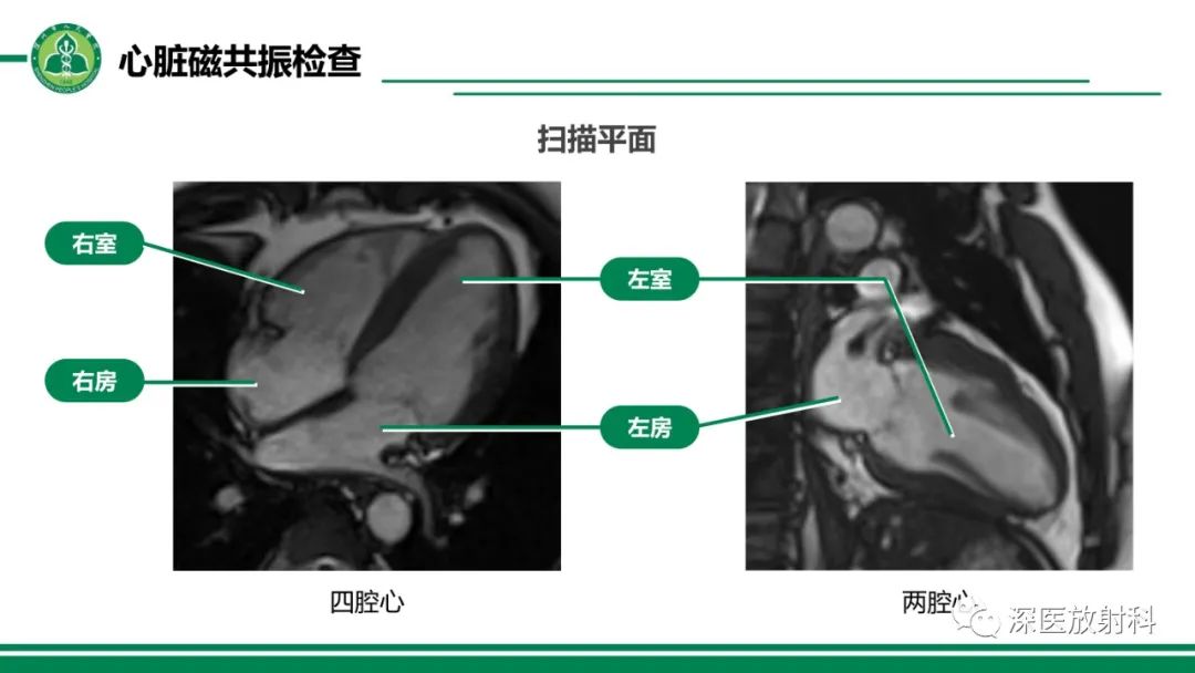 影像PPT - 【PPT】心脏磁共振成像-6