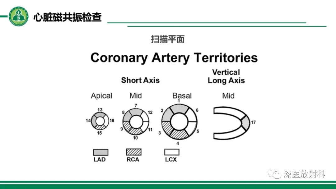 影像PPT - 【PPT】心脏磁共振成像-11
