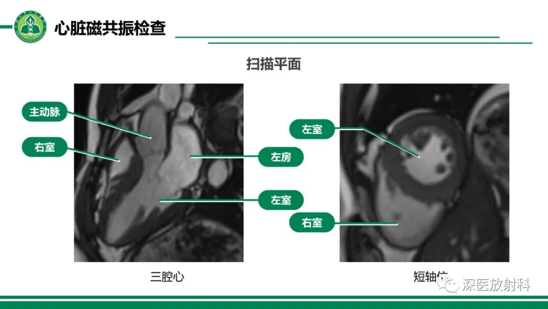 影像PPT - 【PPT】心脏磁共振成像-7