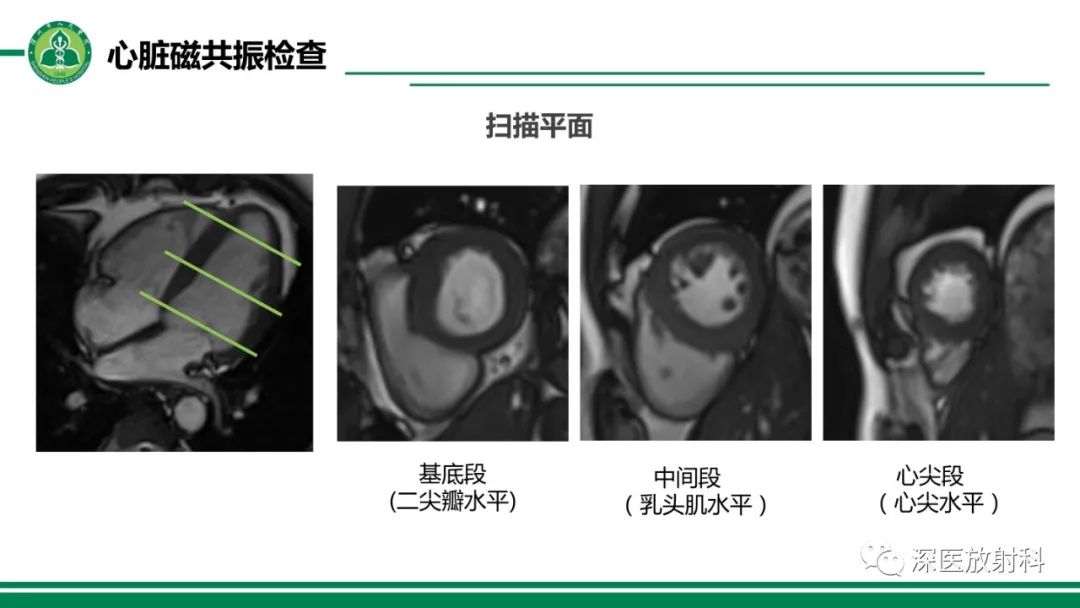 影像PPT - 【PPT】心脏磁共振成像-8