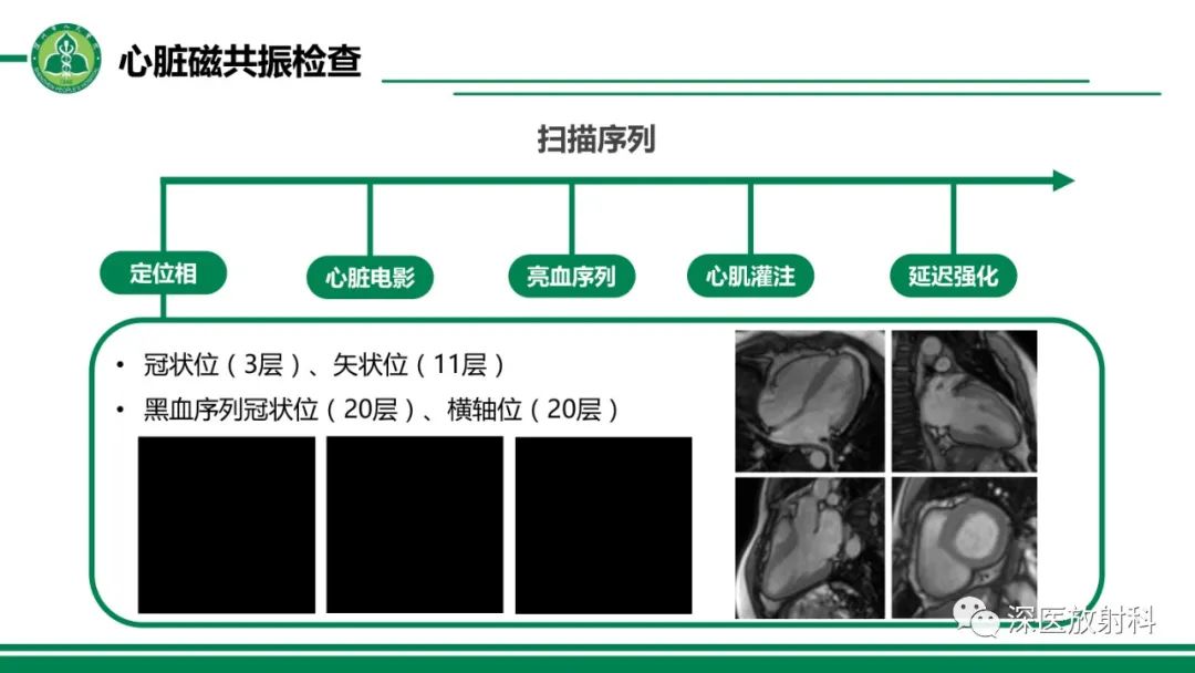 影像PPT - 【PPT】心脏磁共振成像-12